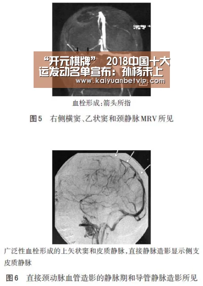“开元棋牌”
2018中国十大运发动名单宣布:孙杨未上榜 第一名见义勇为!(图1) 开元赛事